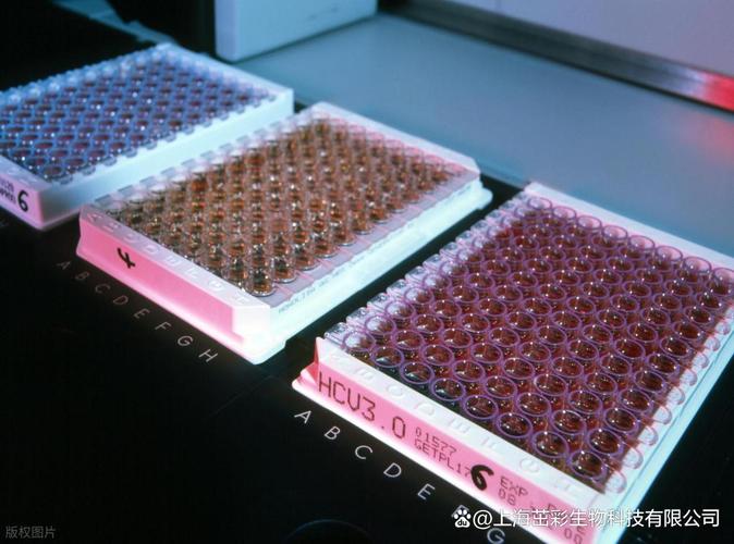 小鼠细胞色素p4502d6(cyp2d6)elisa试剂盒